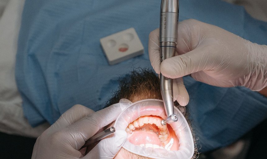 Endodoncia