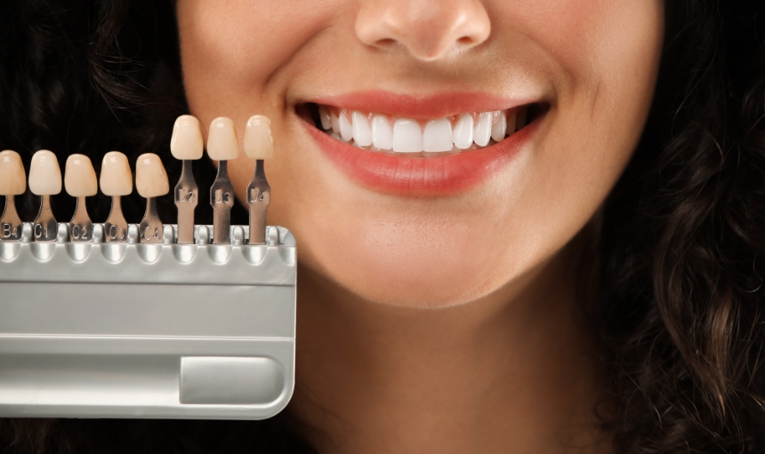 Estética dental