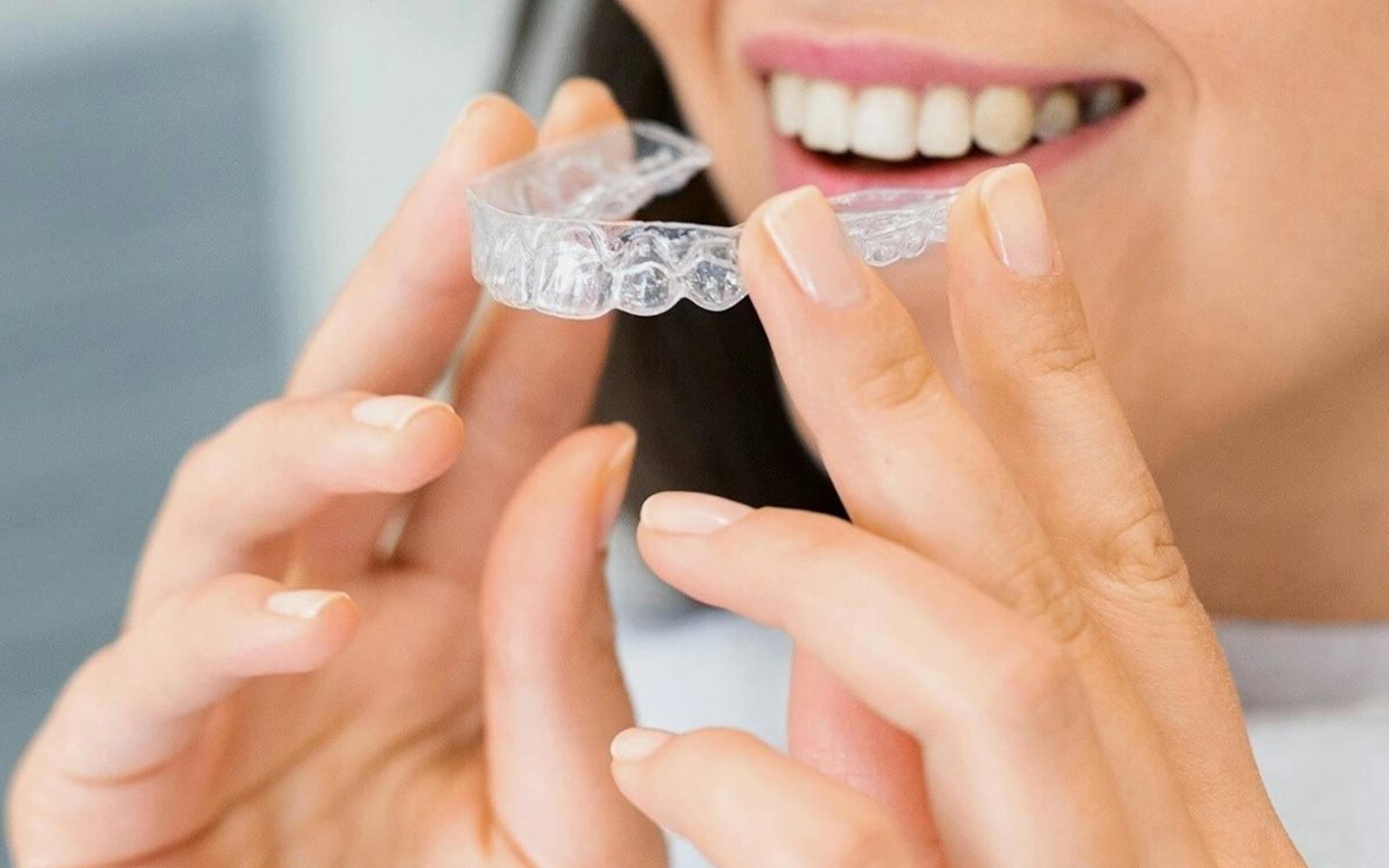 Sonrisa con alineador transparente Invisalign