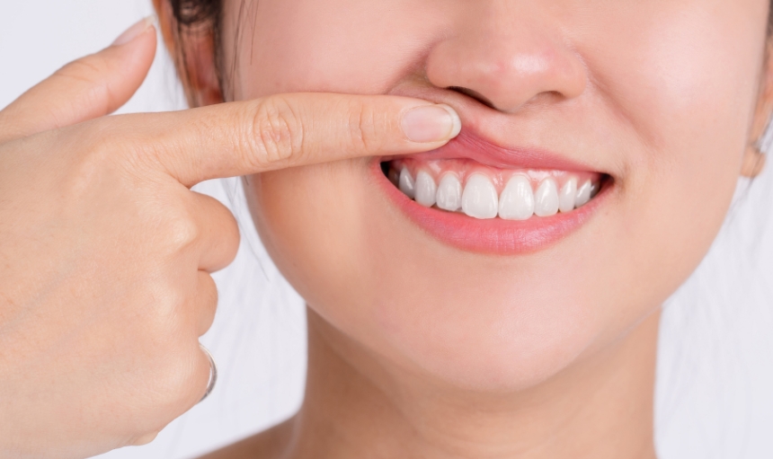 Periodoncia