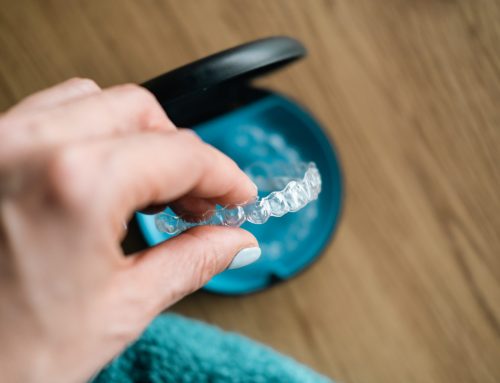 Ortodoncia invisible: una opción estética y efectiva para alinear tu sonrisa