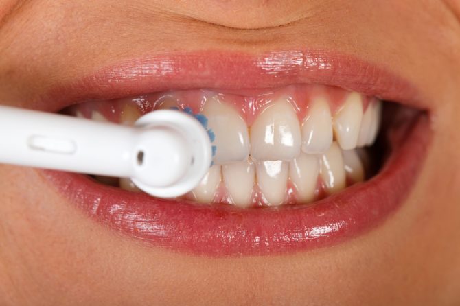 ¿Por qué es esencial una limpieza dental en la Clínica Dental Zeudent?